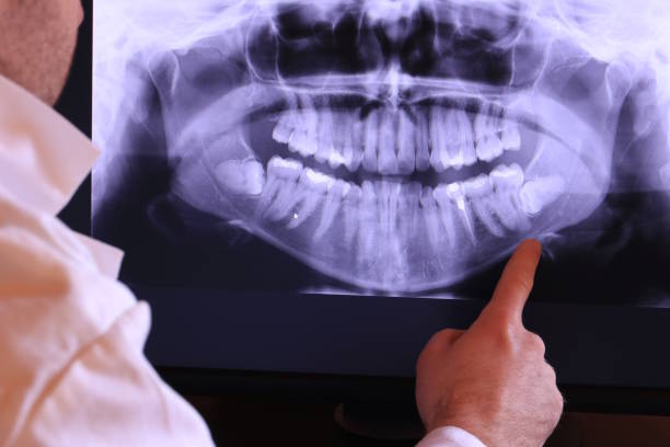 Best Emergency Gum Treatment in Cavalero, WA