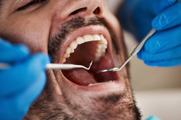 Best Pediatric Emergency Dentist in Cavalero, WA